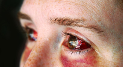 Domestic violence is estimated to rise in San Angelo throughout the holiday season. (Photo from iStock Photo)