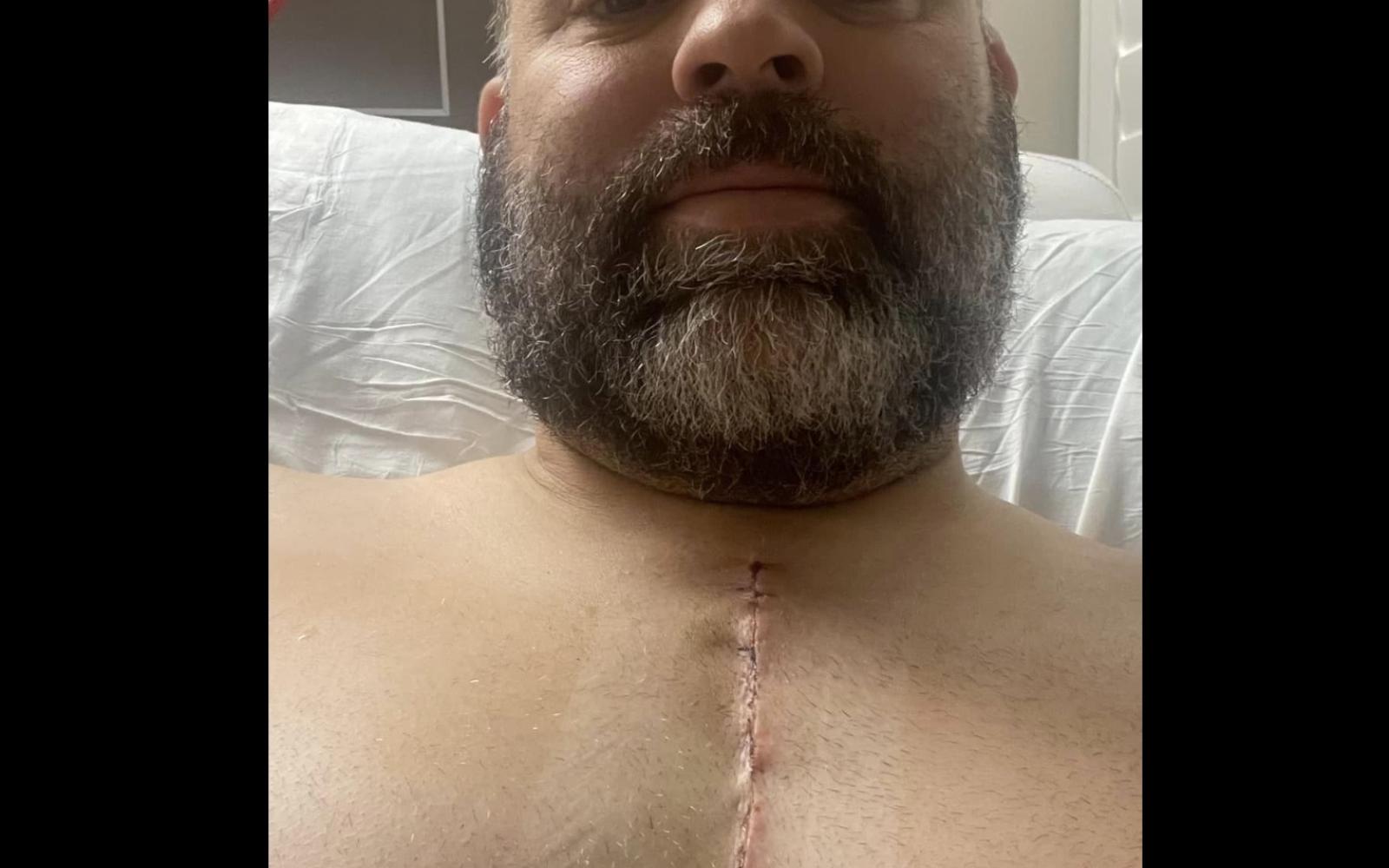 Pettit Post Surgery