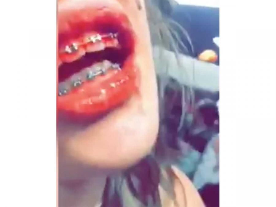 The bloodied mouth of a fight night participant identified as Christina following one of Camp's fights. (Screenshot from Camp's promotional video)