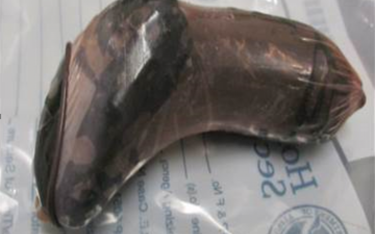 Fentanyl seized from a body cavity (Contributed/CBP)