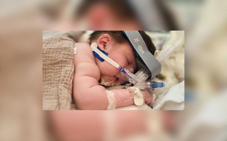A Coleman family is seeking community support for their newborn daughter, who was born with a severe form of Spina Bifida and has undergone multiple surgeries at Dell Children’s Medical Center in Austin.